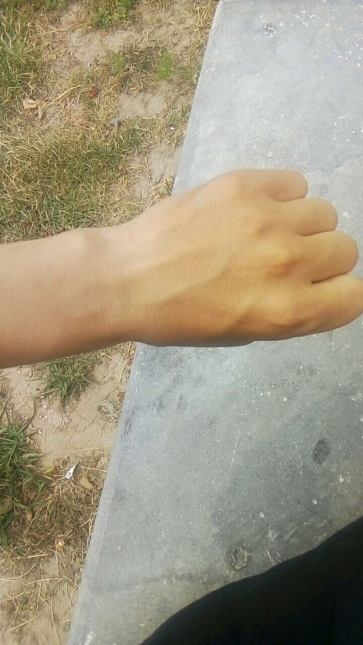 真的要过不下去了，都饿成这样了。真的要过不下去了，都饿成这样了。皮包骨头46 / 作者:狗拖死全家 / 