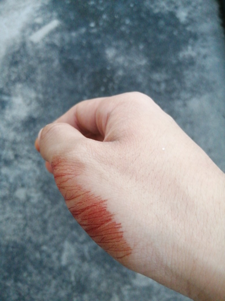 好晕被扎了一刀,日子没法过了,因为她下水