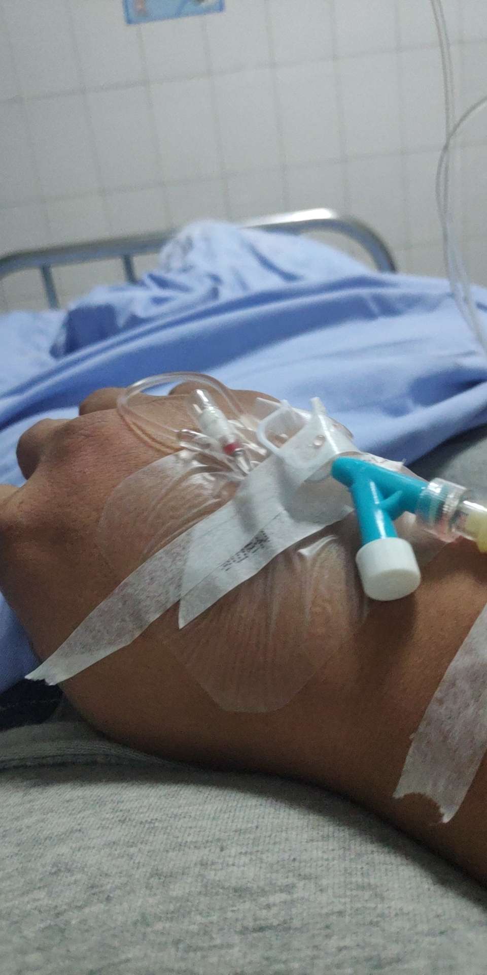 卧槽老哥骑电动车往小区拐弯回家轿车撞了我报了警，交警来轿车和我的电车拖走了，立案27 / 作者:孩子闹不为难 / 
