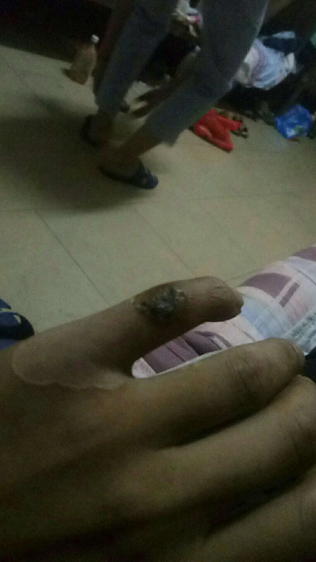 老哥们，我知道今天我错了，但是脚疼了没办法，肚子又饿，又想抽烟，众人帮做完了，脚44 / 作者:80个老哥难受 / 