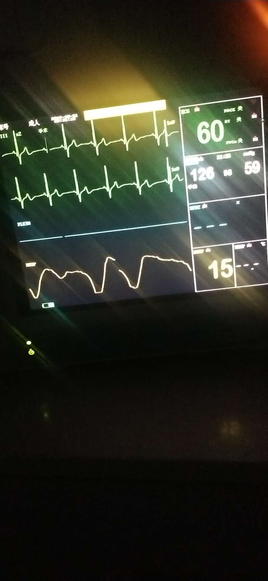 有没有老哥知道下面这跟黄的是指的什么，刚才一直稳定20现在一直降到13了

58 / 作者:Making. / 