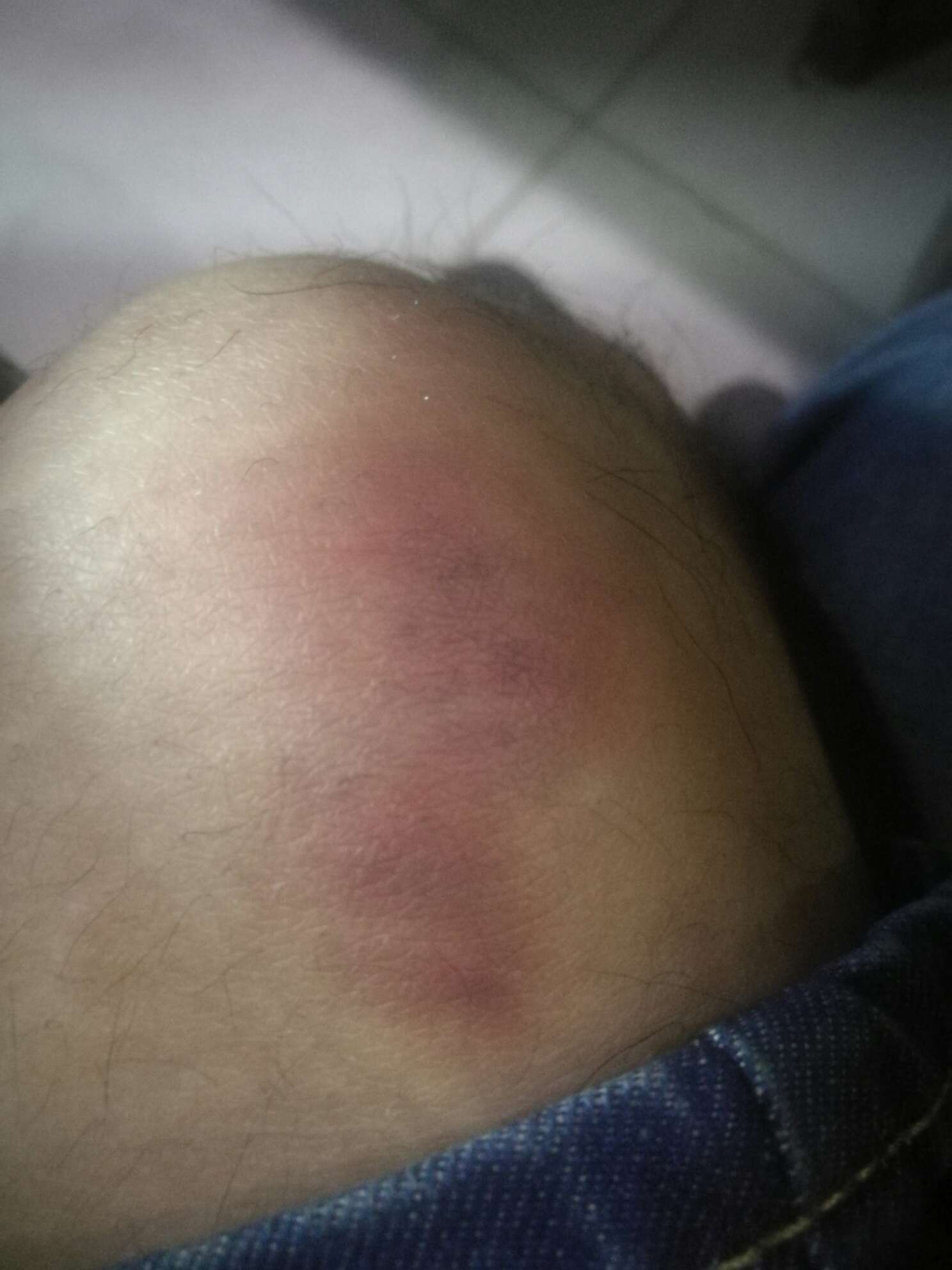 谁知道哪里要日结保安的多，昨天分拣实在受不了啊，装卸车，大腿什么的都磕青了才130
67 / 作者:人在水底游 / 