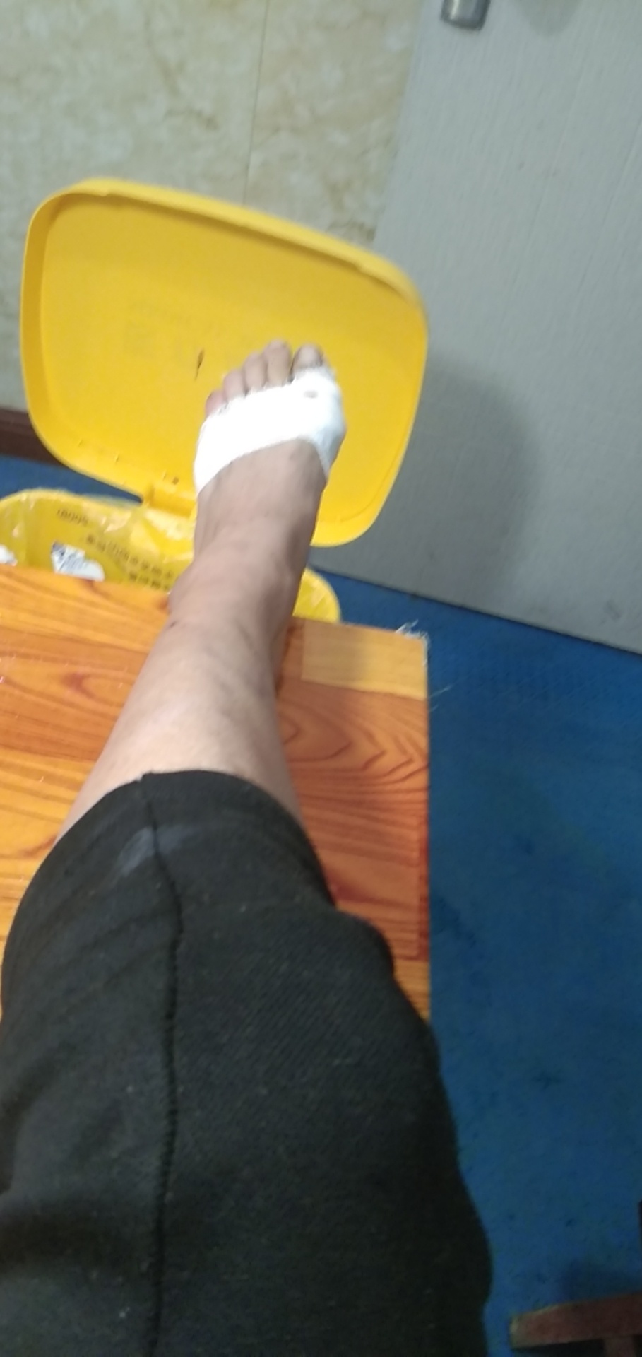 钱没赚到，，，脚却骨折了



0 / 作者:naids / 