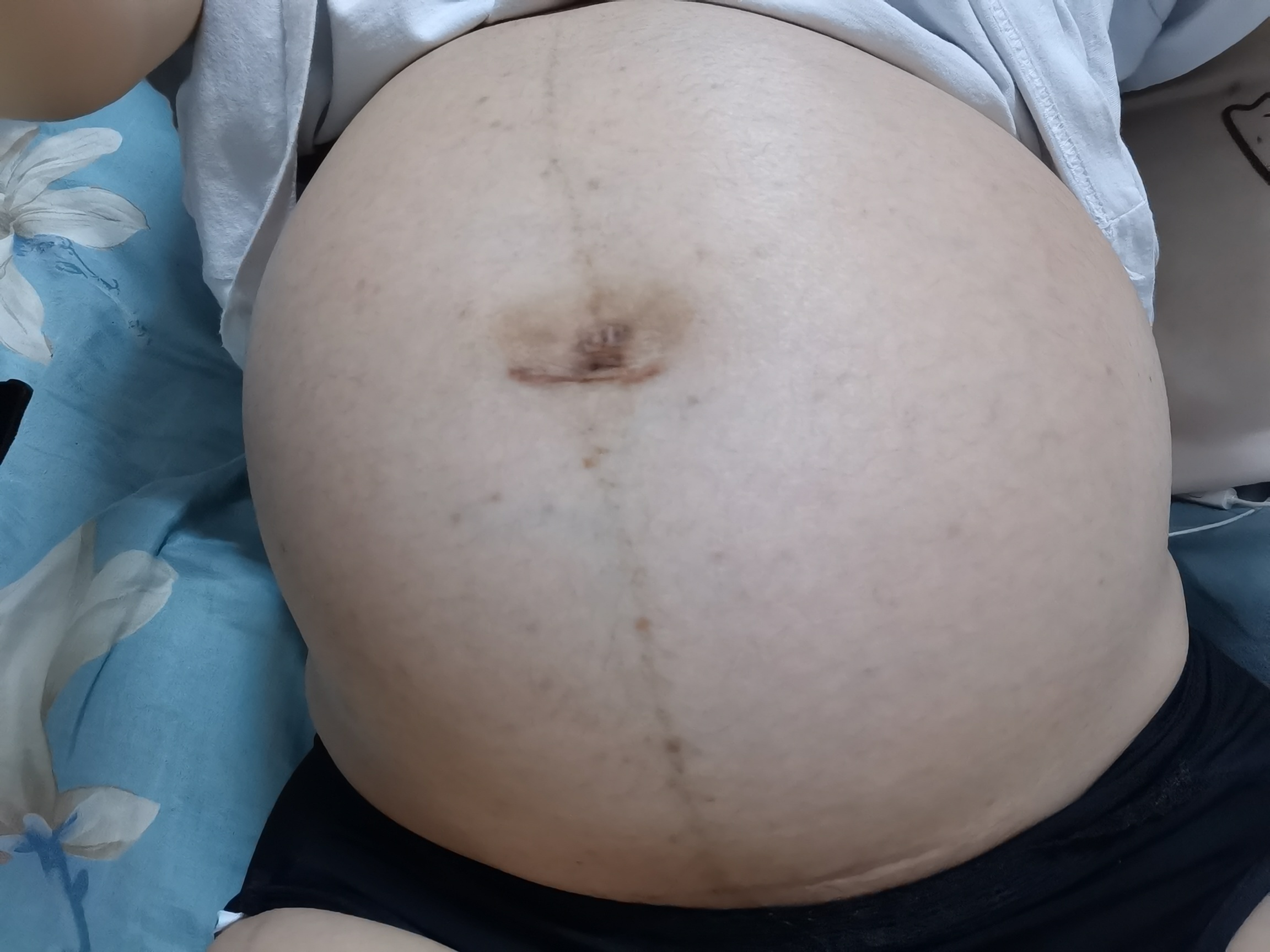 猜猜男孩女孩



0 / 作者:我笑死我了 / 