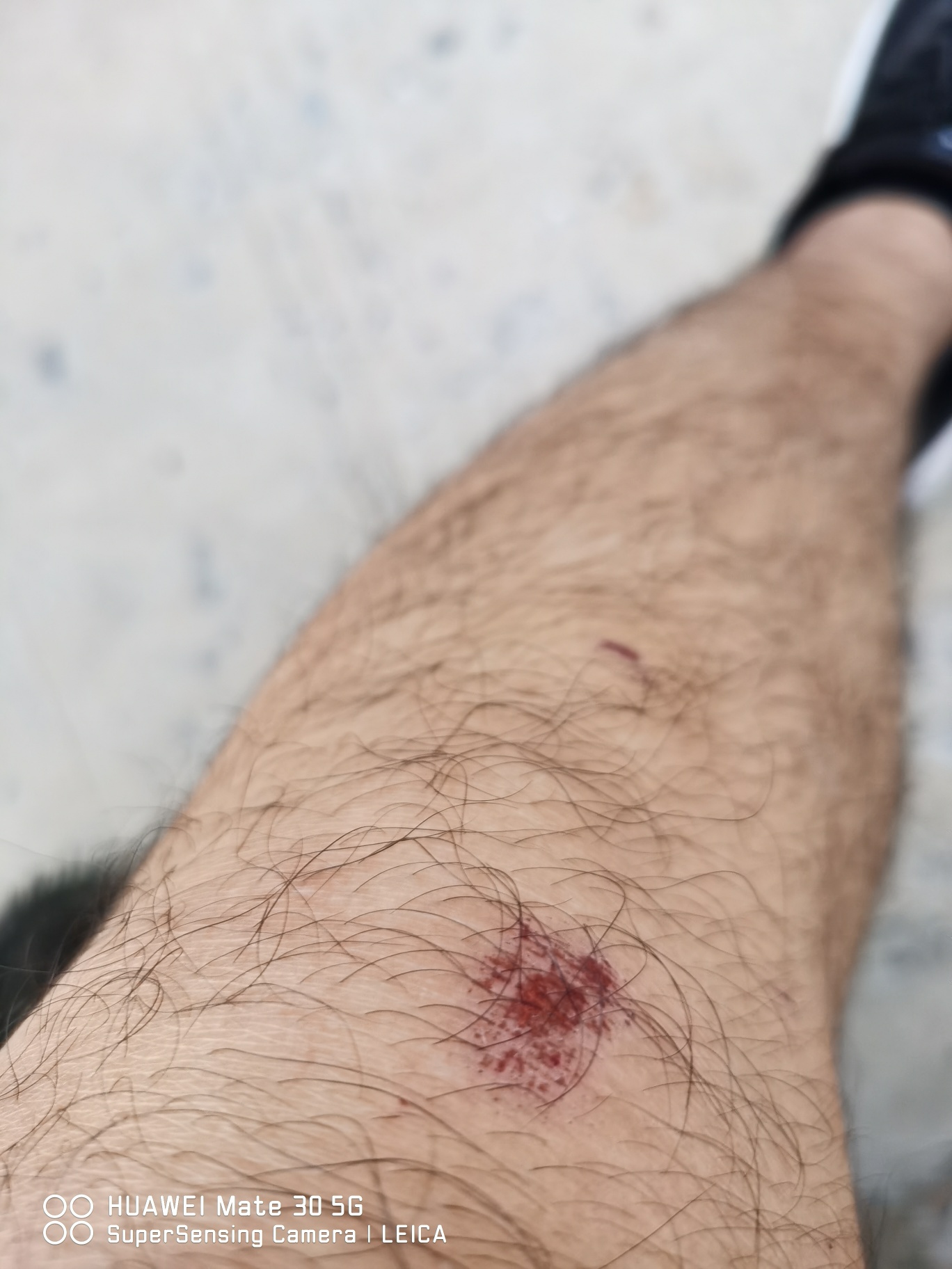 哎，闲下来，就会感受到各种无穷无尽的压力过来，对生活的 家庭的。不止一次我都在想100 / 作者:角落的孩子 / 