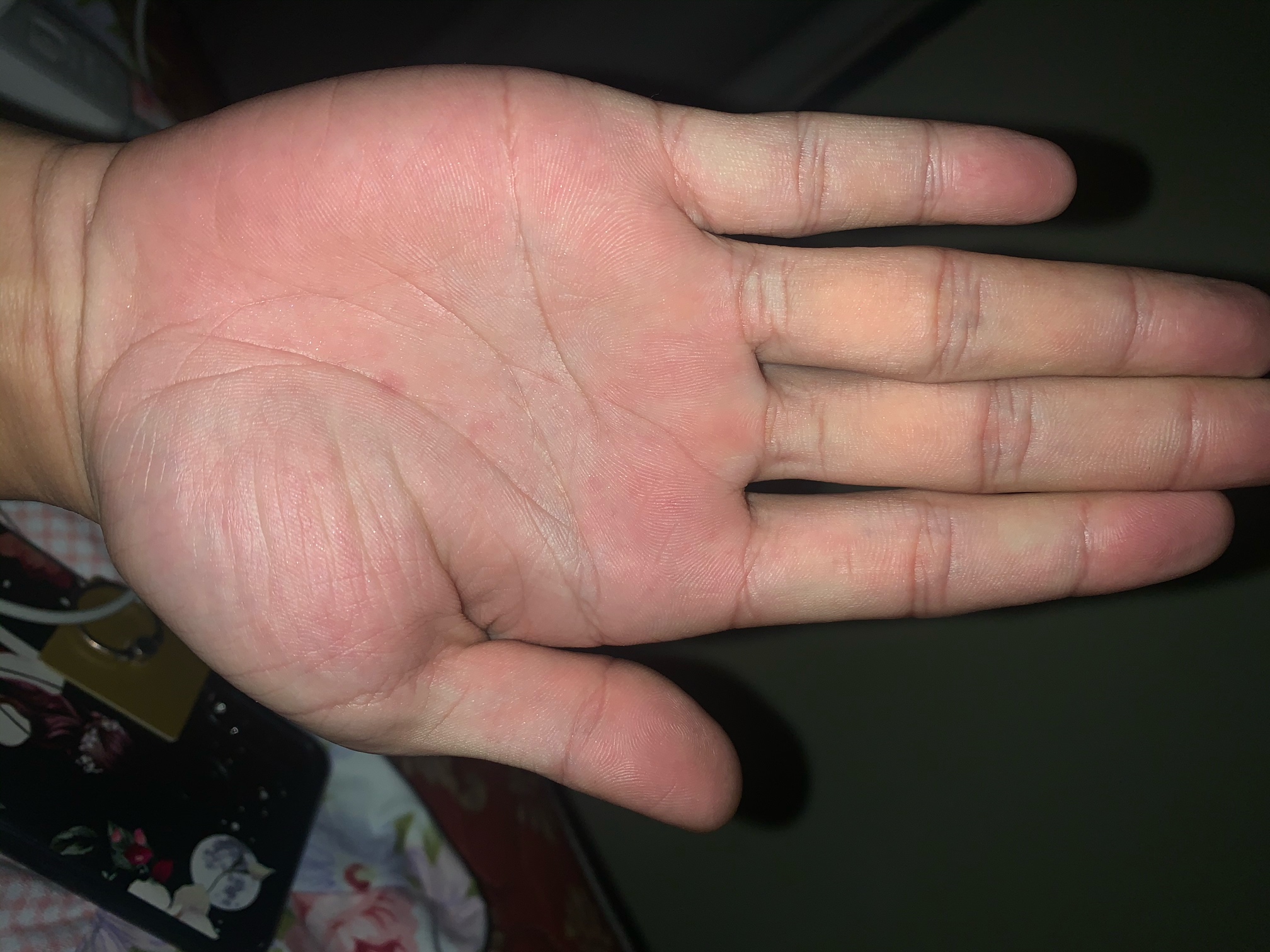 一天一次的看手相摆摊又来了。有偿，随缘打赏花贝。我送你几句话，可看过去记录，没啥1 / 作者:玫瑰园里的我 / 