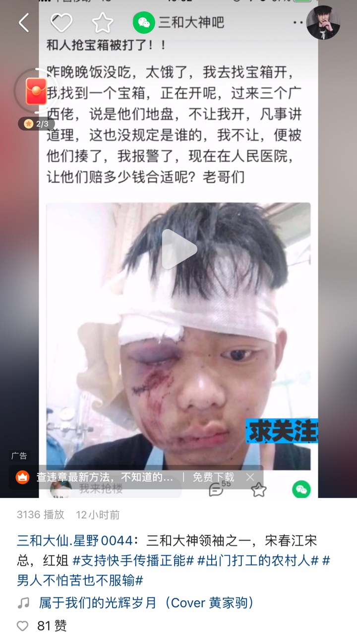 在三和开宝箱的老哥 小心点

16 / 作者:贾正經 / 