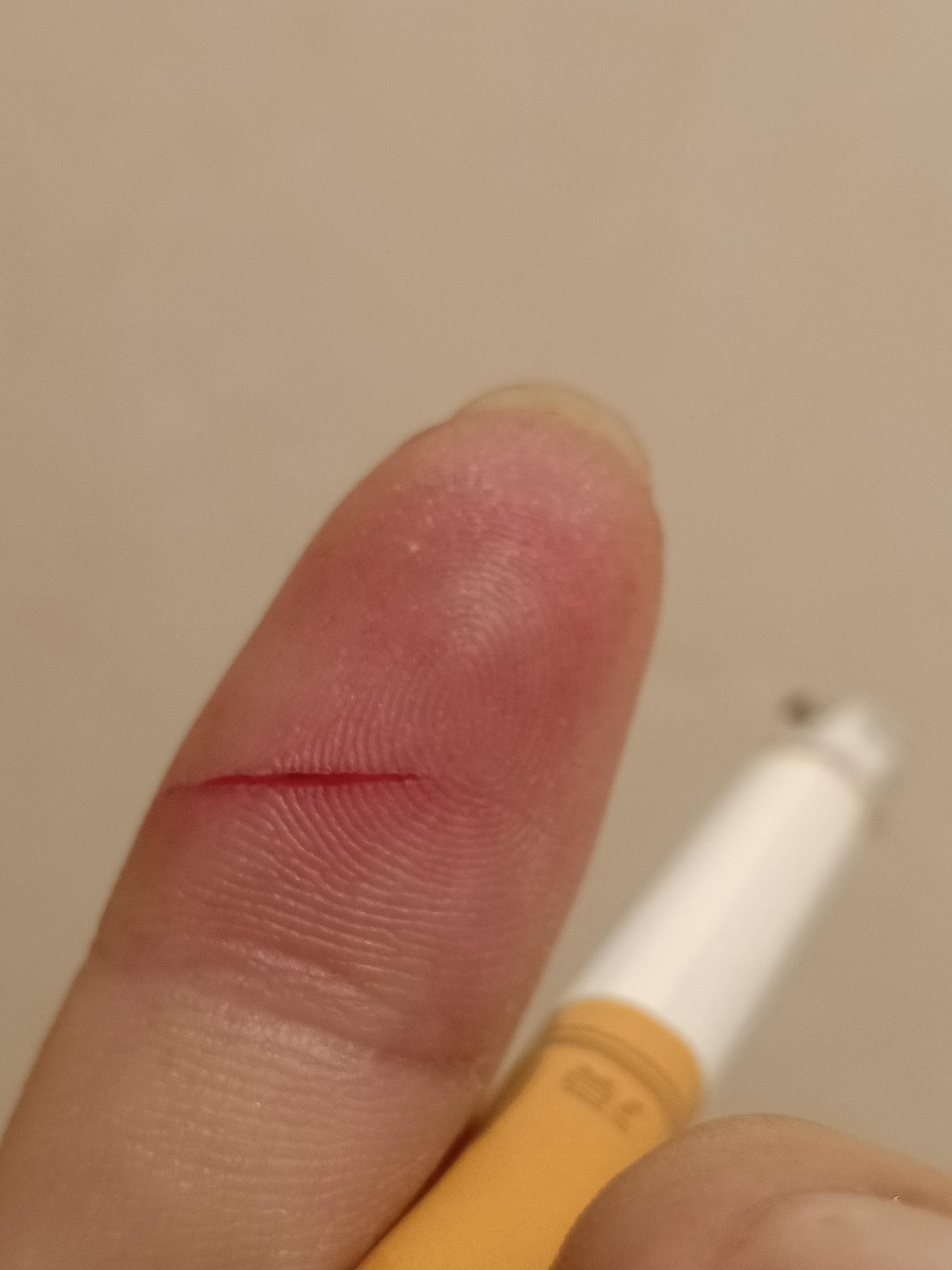 负债300w，强制上岸，过年来一下，时刻提醒自己，后半生不为自己而活，努力还债，下辈26 / 作者:下辈子不来了 / 