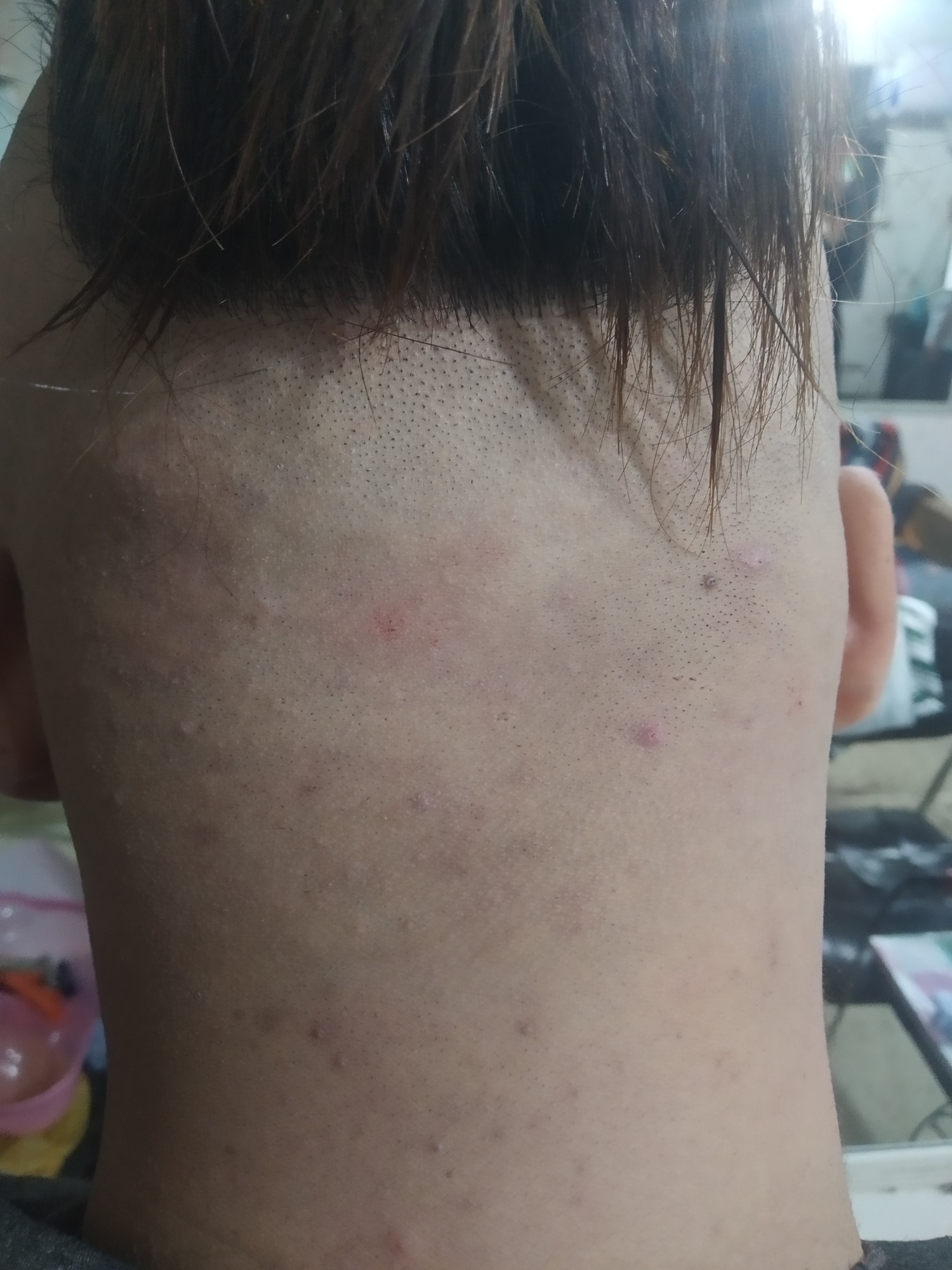 zfb，jd所有全面于期，已经强制，没有起诉，要不要继续搞租机，租机会起诉吧？

29 / 作者:一丝人味 / 