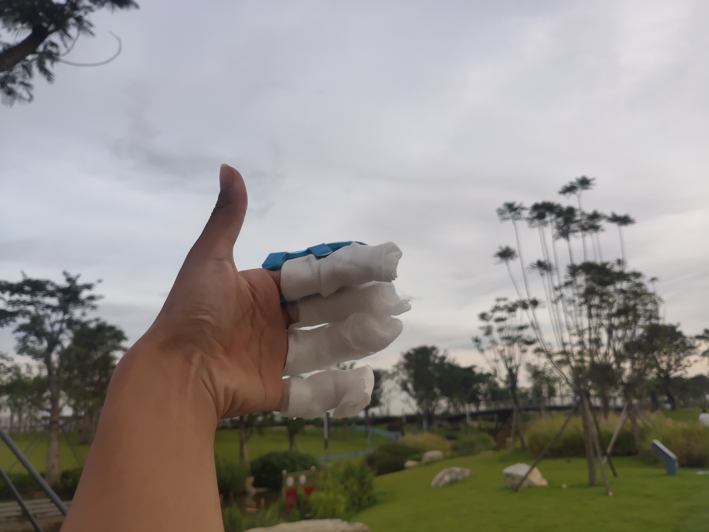 在工厂骨折，工伤申请下来了，社保局说做个鉴定保底十级工伤，老板也愿意赔偿，大概121 / 作者:XJ. / 