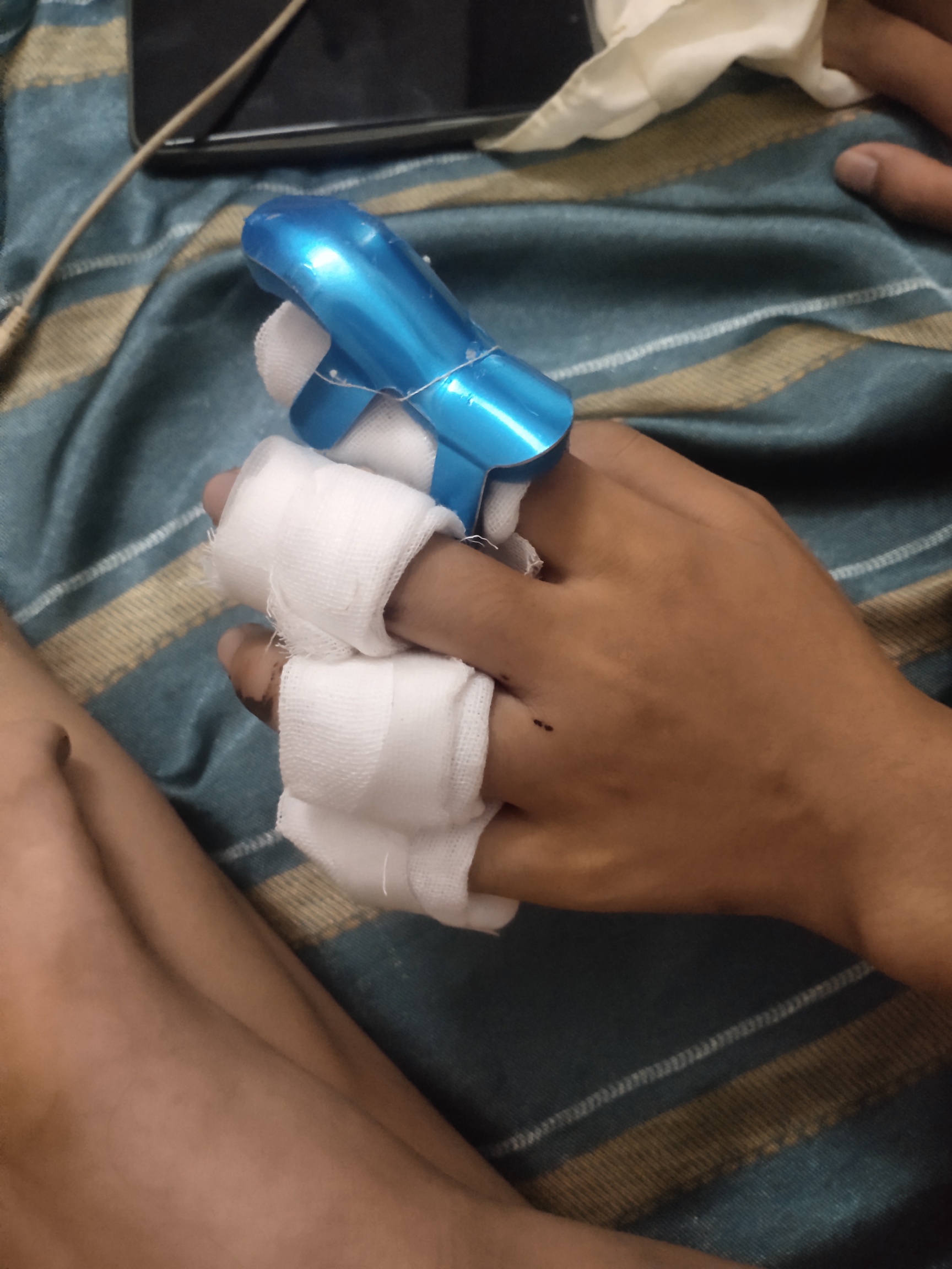 在工厂骨折，工伤申请下来了，社保局说做个鉴定保底十级工伤，老板也愿意赔偿，大概1250 / 作者:XJ. / 