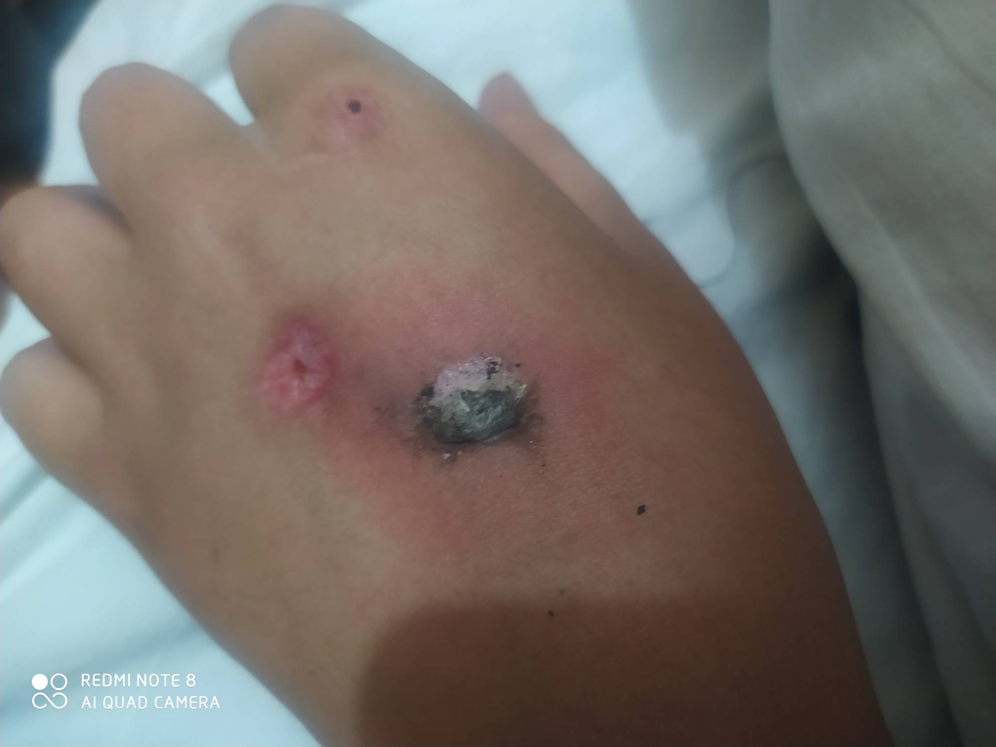 一股焦香味

77 / 作者:苟活的狗 / 