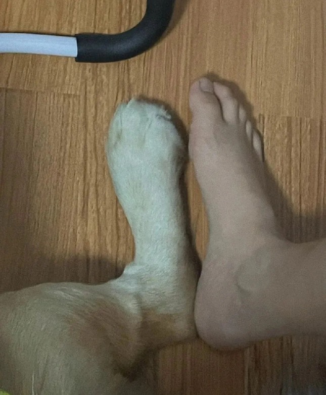 昨天抗原测出来异常，腿特别痒，挠了一晚上今天就变成这样了。我还有救吗

99 / 作者:我用华为你用啥 / 