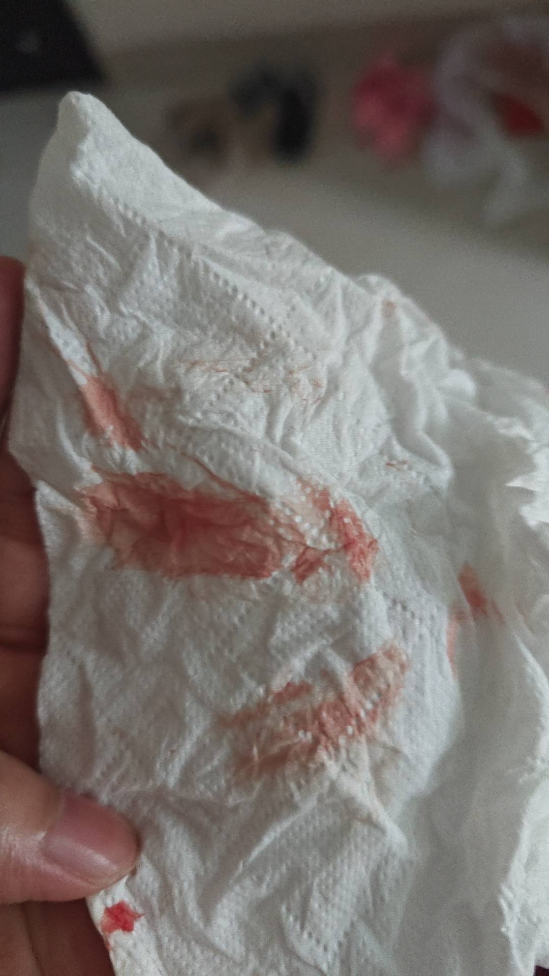 有没有老哥懂男士医科，因为尿频有炎症 刚刚一直捣鼓根部突然白色液体夹杂着血流出来75 / 作者:新手司机杰 / 