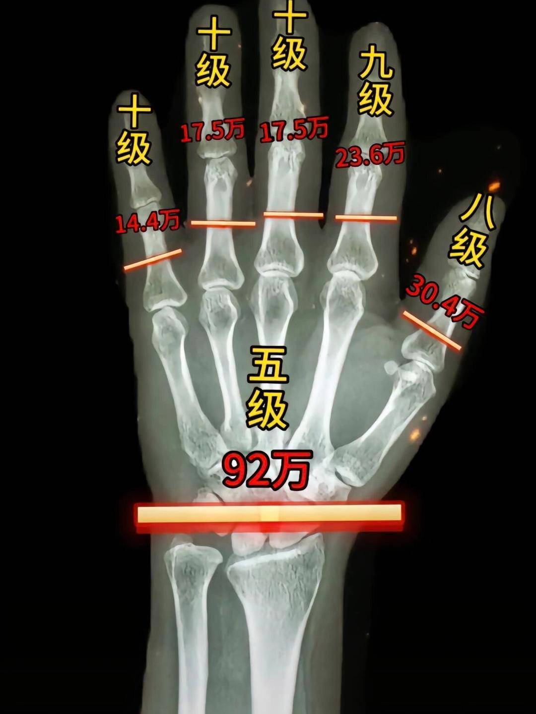 老哥们，给20个断一根手指你们换吗

0 / 作者:期待mgy / 