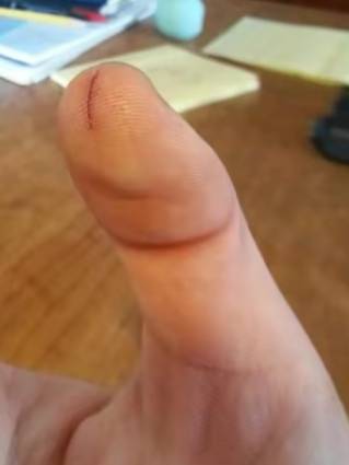 切西瓜弄到手了

81 / 作者:人死鸟朝天 / 
