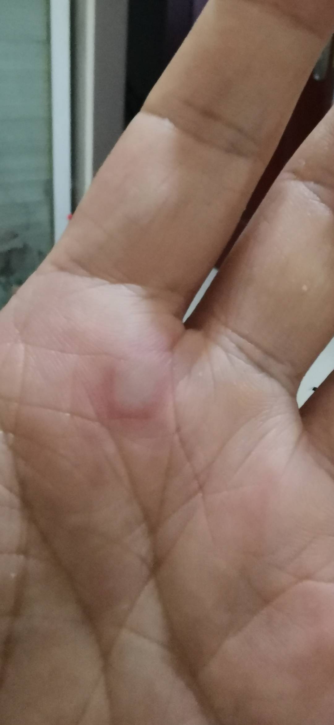 买了个好打火机，第一天就把手烫了个大泡，我真是无语了。忘了这个开关在侧面了。兜里46 / 作者:龙飞呀 / 
