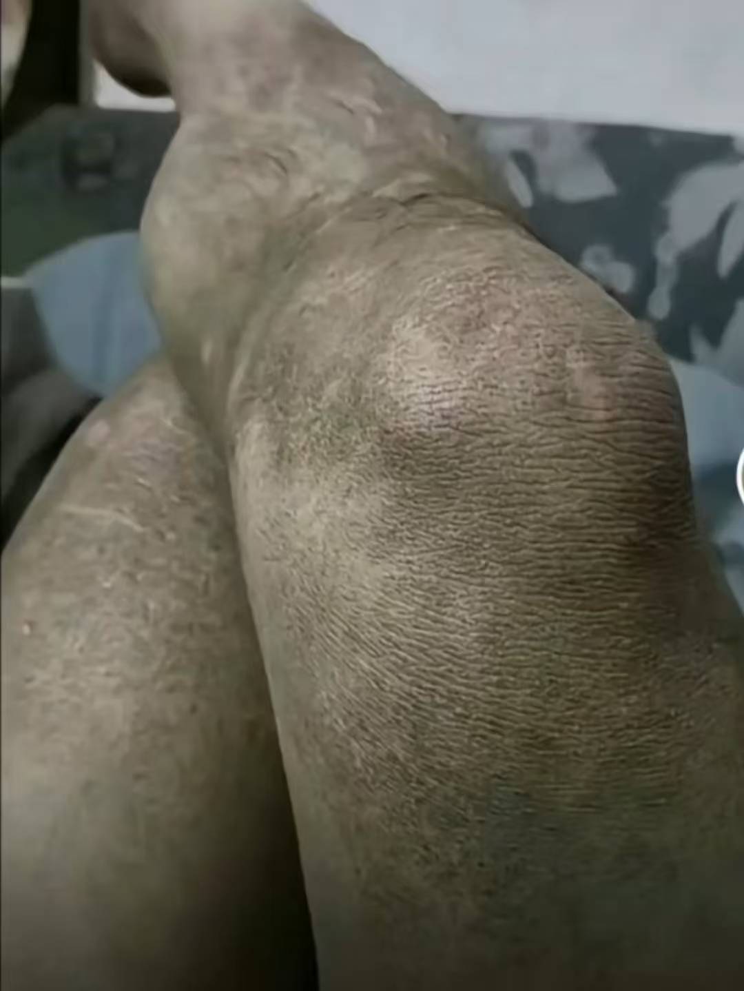 打了娇娇电话，任何话术s活说，还是不给补偿，最后说不给就去他们总行t楼就给了！

64 / 作者:天桥下面好冷 / 