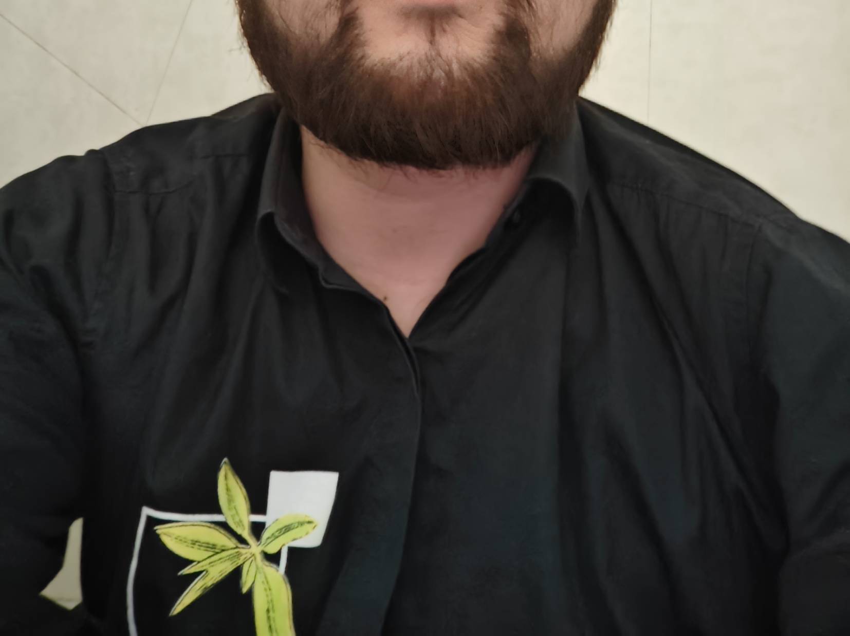 才三天没刮胡子，又长的跟欧洲人一样满脸胡须了
52 / 作者:牛牙雅夏虾 / 