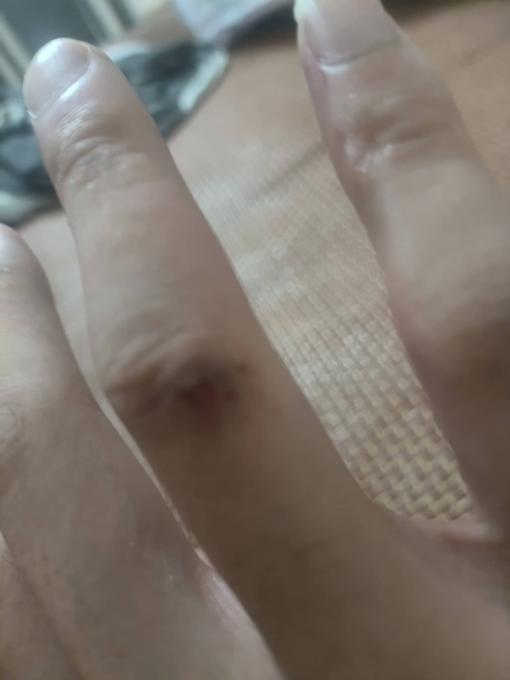手锤成这样了，直不起来了

0 / 作者:kim哥哥 / 
