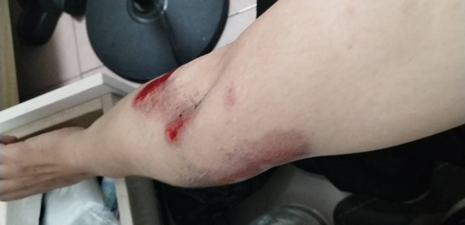 我现在这个胳膊疼的厉害，车子也摔坏了，我要求是给我换个新车就好了

17 / 作者:挂比了救我鸭 / 