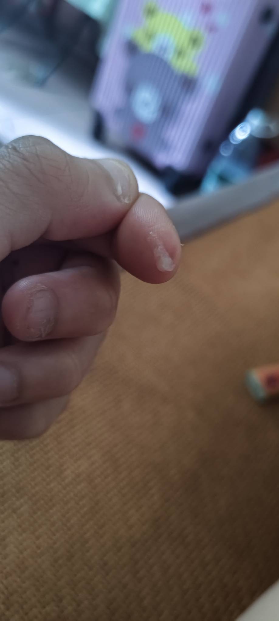 这是怎么回事，每次打喷嚏喉咙里都会打出这些浓痰。。

93 / 作者:晴空未来 / 