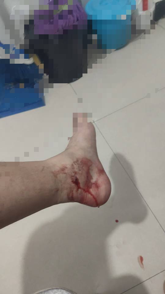 老哥们，坐标通州马驹桥，我去医院缝几针七百块够吗？？没钱了，血流不止。骑车摔的。96 / 作者:清风作伴 / 