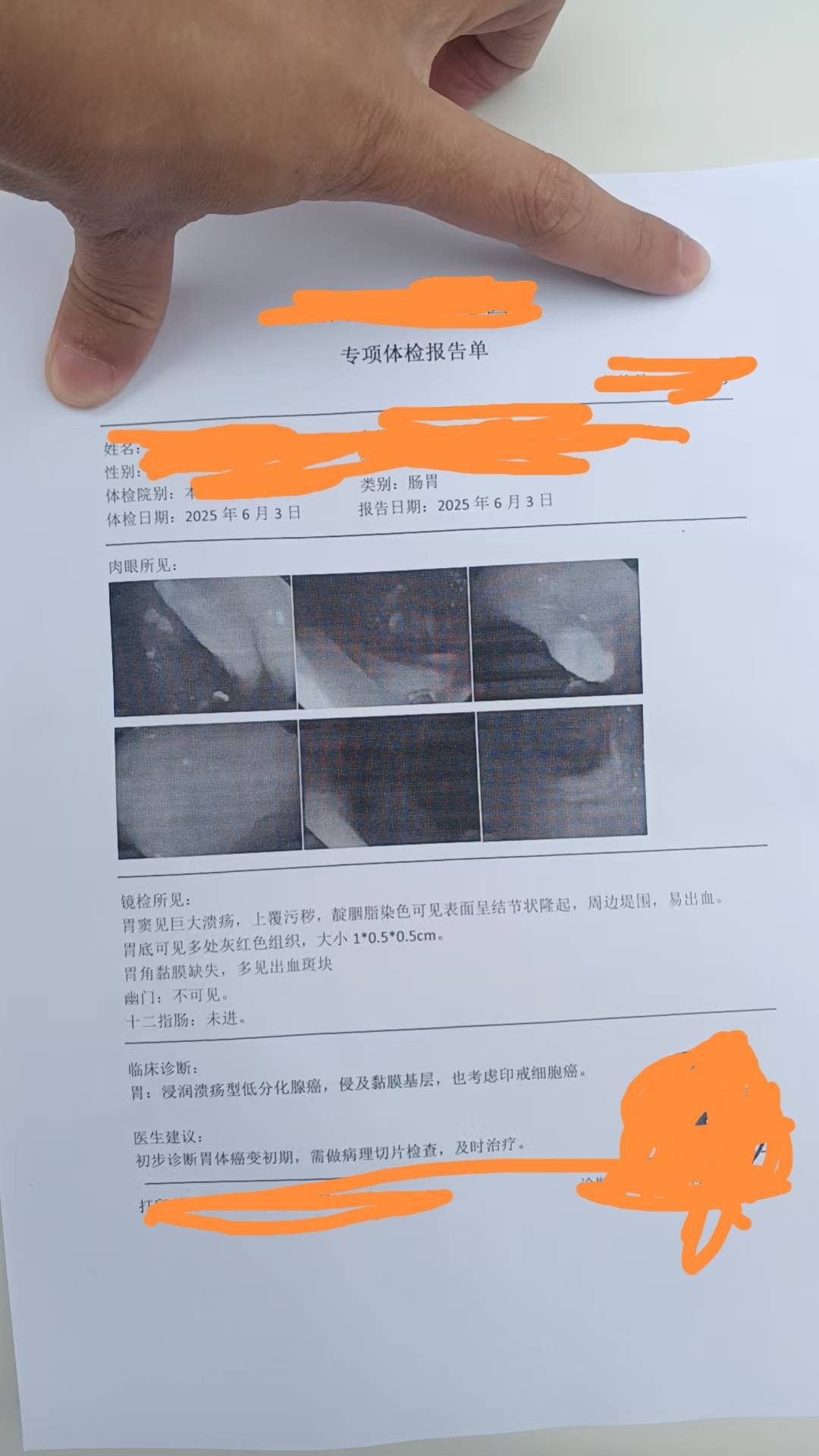 经常有老哥说着玩要重启，我这是真要重启了，胃癌没钱治，慢慢等死了，老哥们保重好身48 / 作者:起名字费劲 / 
