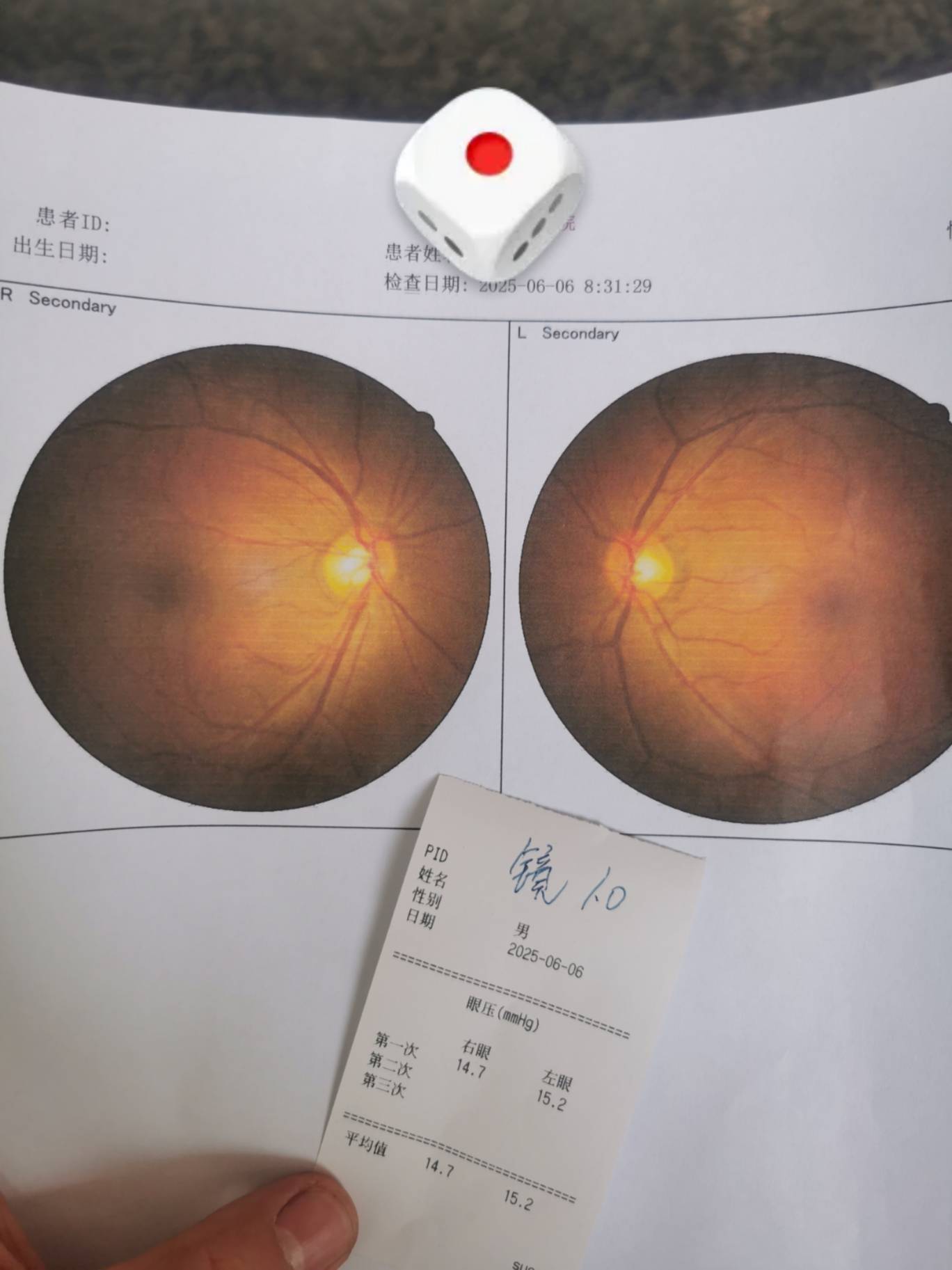 我这在眼科医院 检查了半天，大夫突然有事，走了。听说今天可能不回来了，这是啥医院55 / 作者:龙飞呀 / 