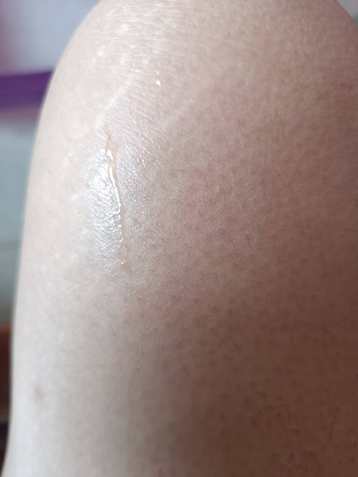 受不了，没空调，这天气又热湿度又大，在屋里都浑身冒汗

68 / 作者:生蚝熟了 / 