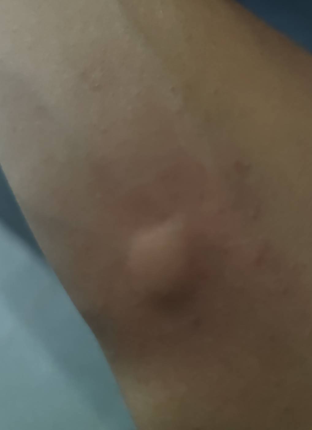 被蚊子折磨醒了 迷迷糊糊睡了三个多小时 中间好像还刮了一会儿大风 这会儿又开始冒汗9 / 作者:赫赫赫连 / 