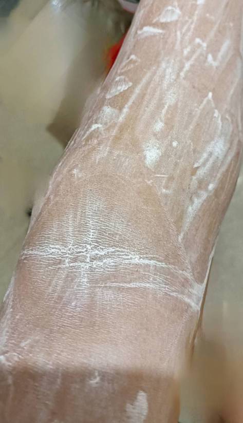 唉，热的胳膊上长痱子了，抹的炉甘石洗剂

50 / 作者:生蚝熟了 / 