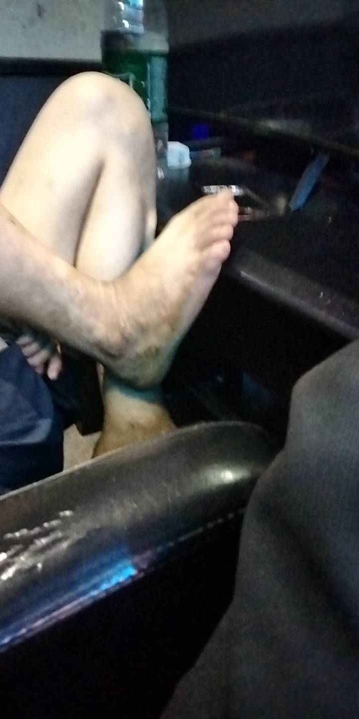 每次睡着，这老哥的脚丫子就到我头上了，好几次了让他洗洗都不去


54 / 作者:宁波躺平老哥 / 
