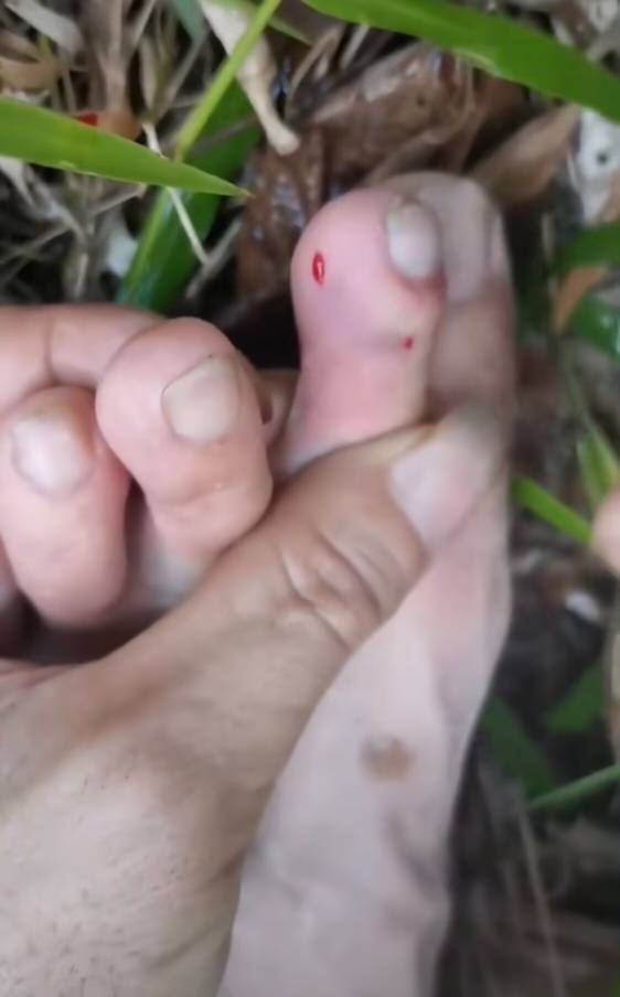 这回真完了 这是什么蛇老哥们 抓黄鳝没看到这玩意 脚被咬了一口


66 / 作者:保安室吴大爷 / 