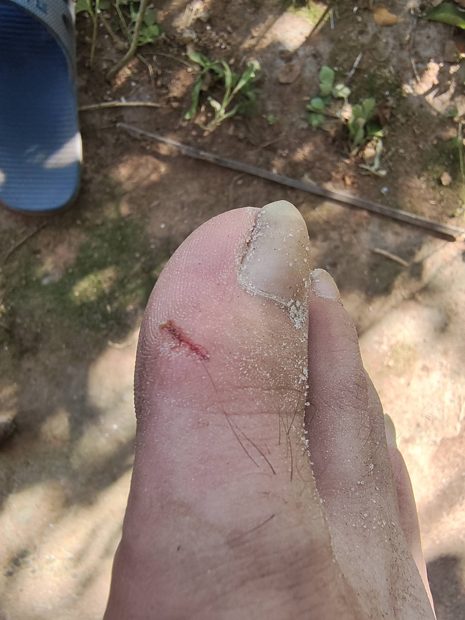 逗狗被咬了，必须得打疫苗吗打多少针

15 / 作者:夏天001 / 