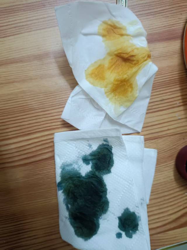 有没有懂这玩意的老哥，都是在邮生活拿下的挂比纸巾，用碘伏滴了一下，有两个滴着看颜65 / 作者:佛山靓仔六 / 
