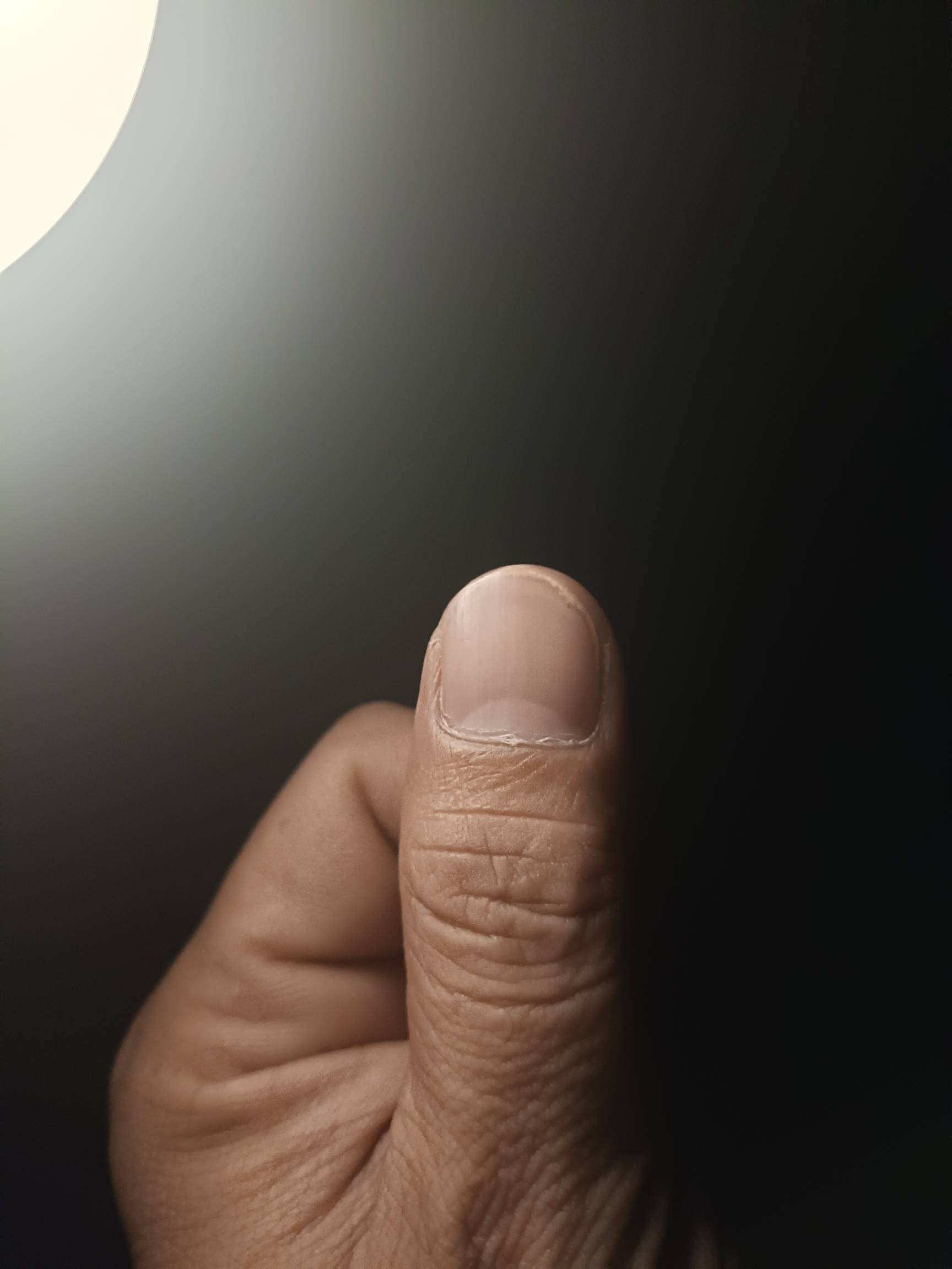 听专家说有月牙的才能熬夜！各位老哥自己看一下有没有

54 / 作者:非凡哥. / 