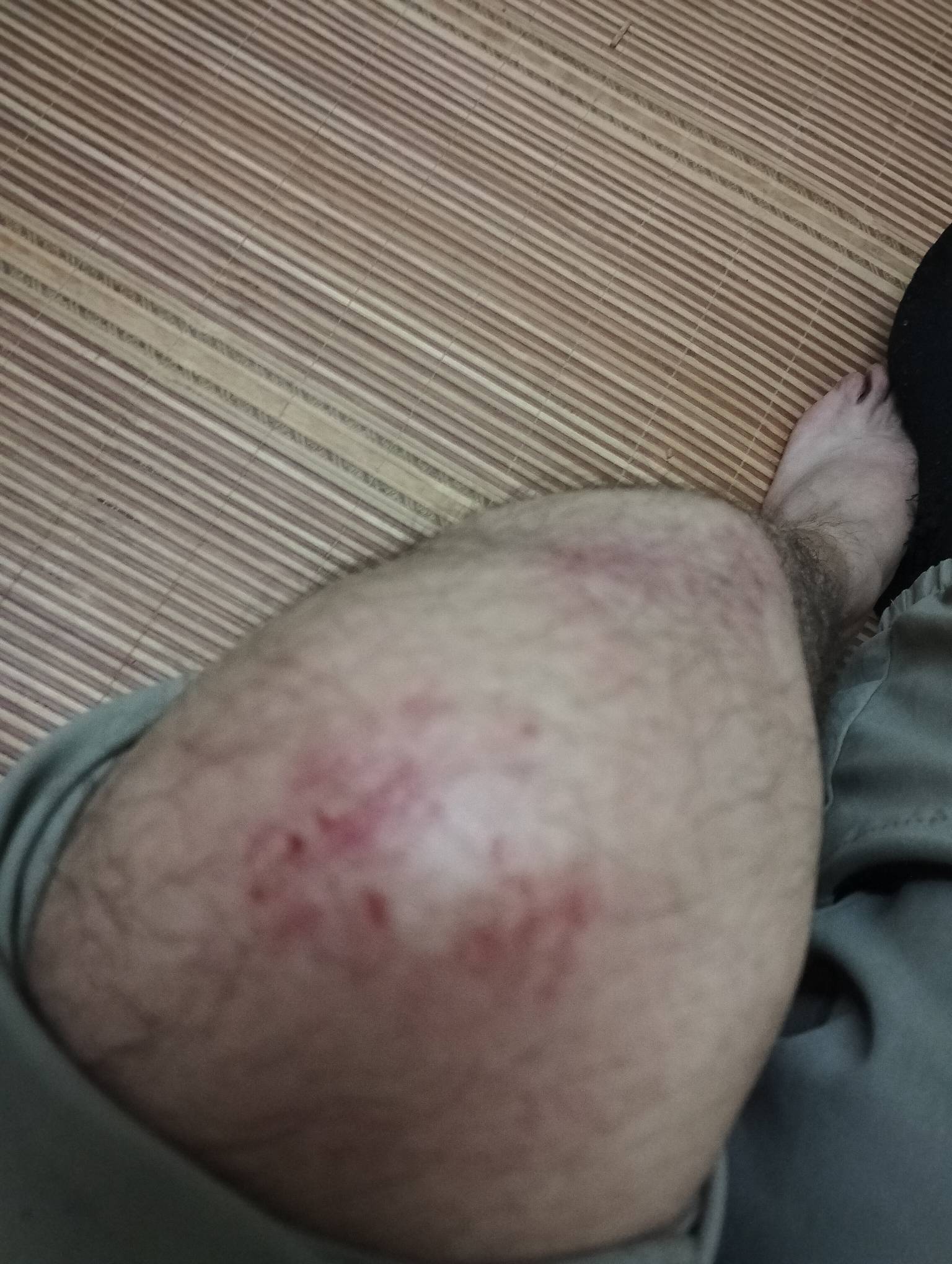 送外卖摔倒了，左边腿走路就疼，我记得电动车倒了了压在我的腿上的时候，那种感觉说不41 / 作者:清风作伴 / 