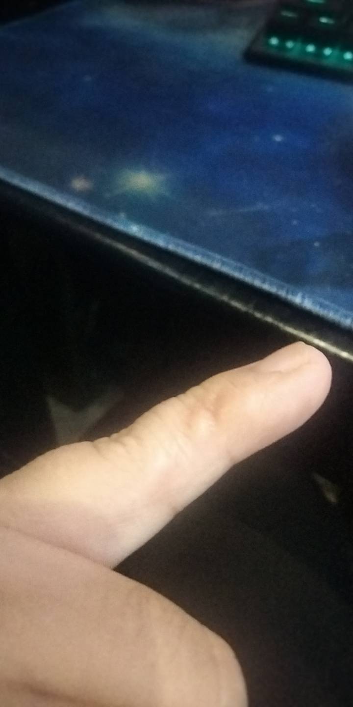 你们每天拿着手机都是这个动作么？最近拿手机拿的太久了，小母手指头，特得要命……78 / 作者:宁波躺平老哥 / 