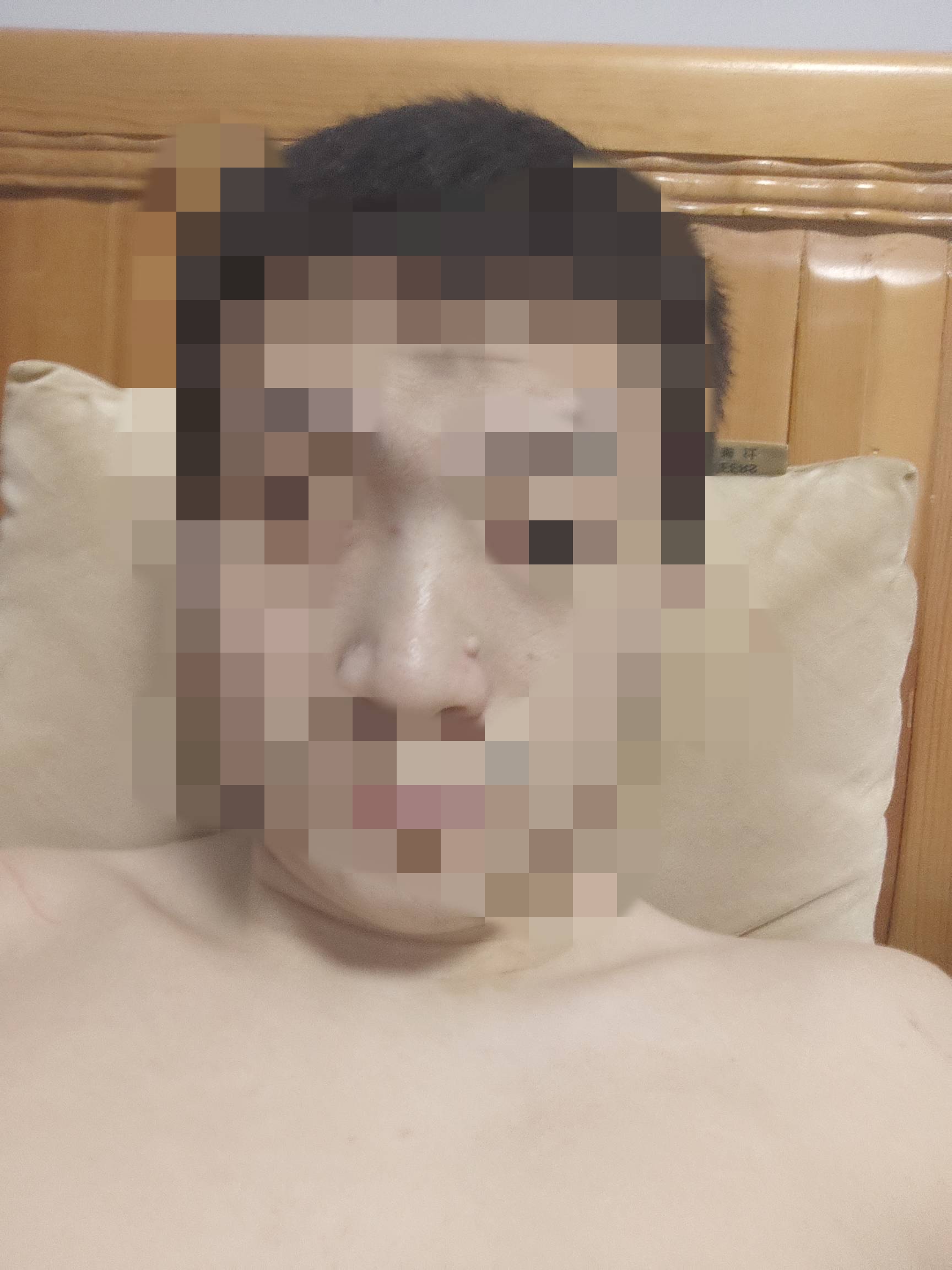  这样看，是不是鼻子的肉球，也不明显，不切也行是吧？

54 / 作者:竹舟 / 