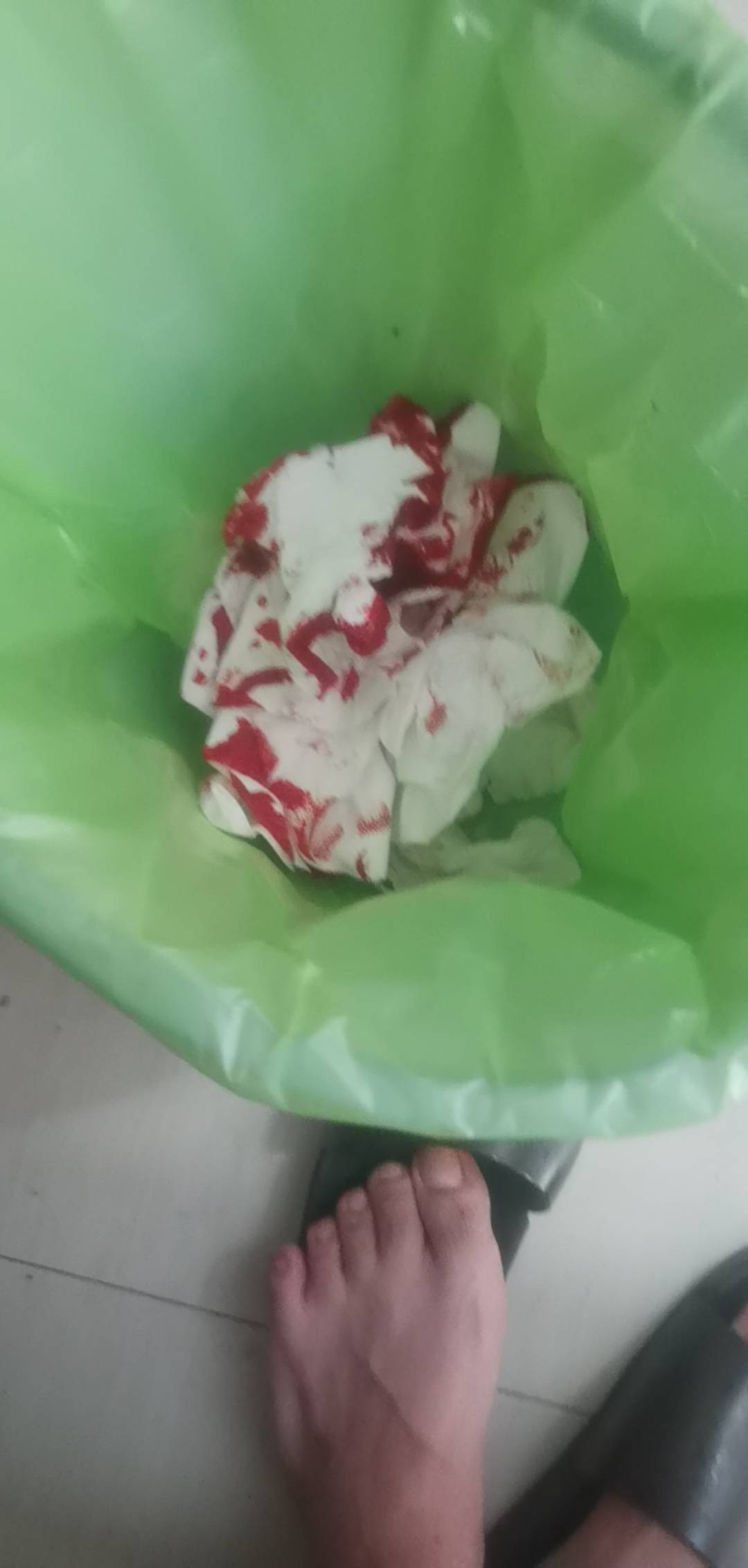 躺床上，一坐起来，头撞上上面的架子开瓢了，血花四溅，我也是服了我自己了


95 / 作者:我是一只卡奴v / 