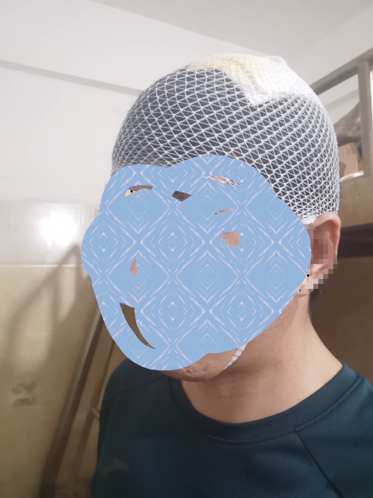 老哥们尽情的笑话我吧，就在楼下附近的诊所处理了一下一起居然要690块，那医生还想叫67 / 作者:我是一只卡奴v / 