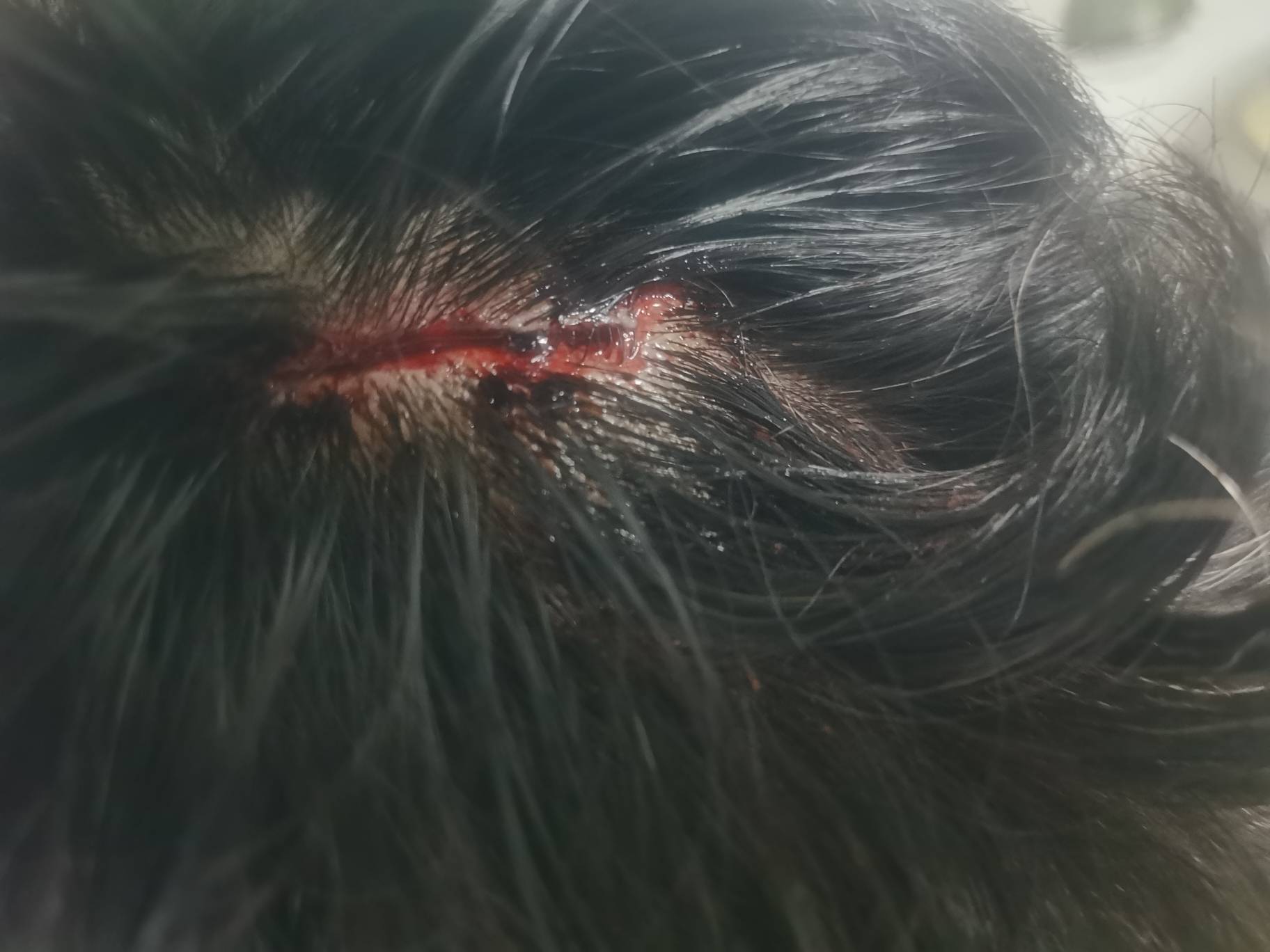 老哥们尽情的笑话我吧，就在楼下附近的诊所处理了一下一起居然要690块，那医生还想叫46 / 作者:我是一只卡奴v / 