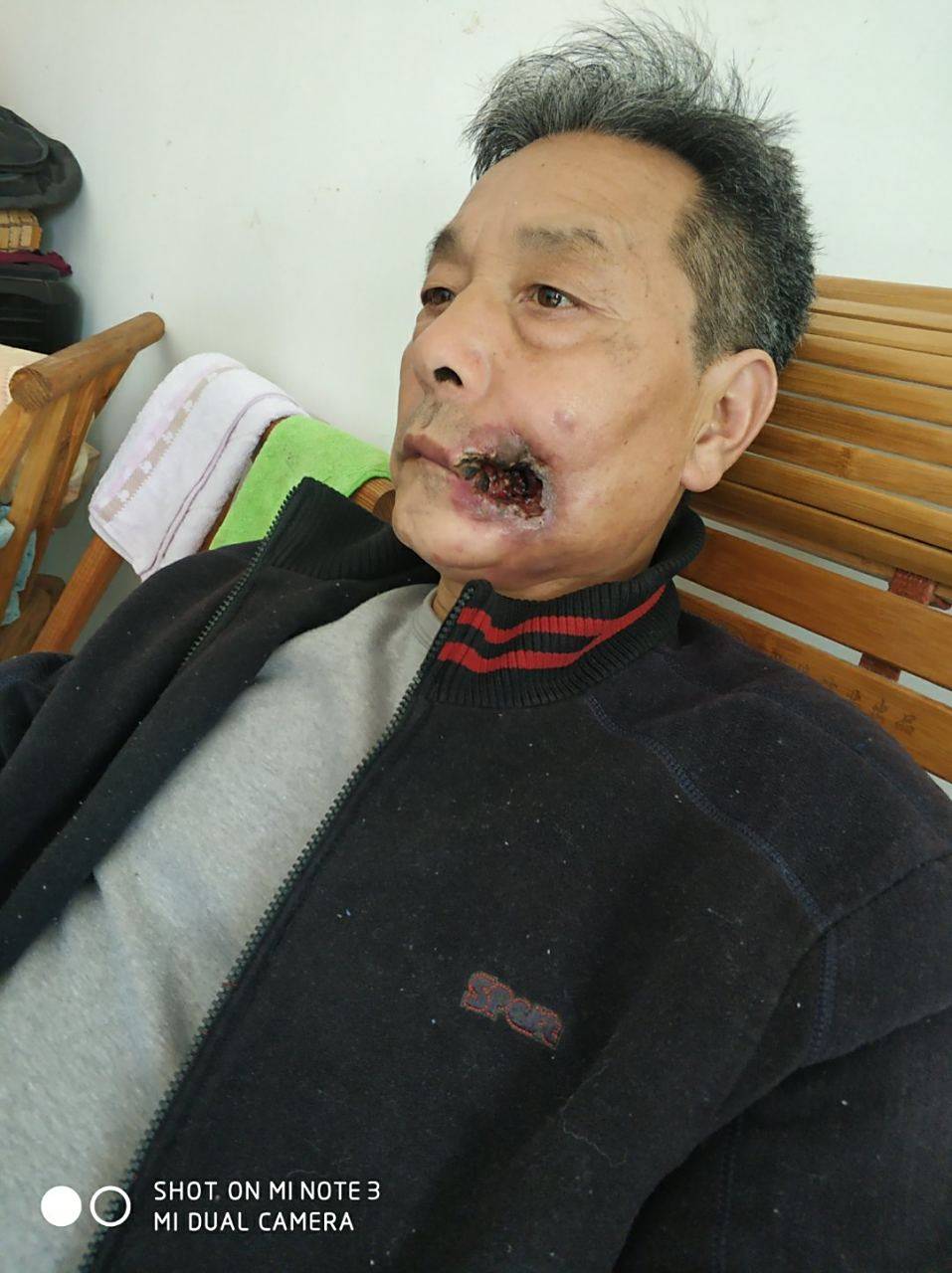别槟榔了真不知道这玩意有啥吃头那么上瘾吗


29 / 作者:心善脾气倔 / 