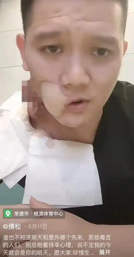 别槟榔了真不知道这玩意有啥吃头那么上瘾吗


19 / 作者:心善脾气倔 / 