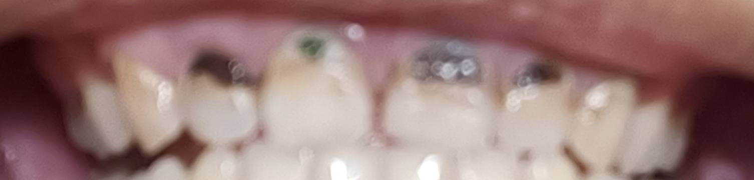 老哥们，心脏痛，又得吃这个药了，这个药止痛挺猛的。感冒发烧头痛，吃下去不到10分钟3 / 作者:挂壁老哥饿了mm / 