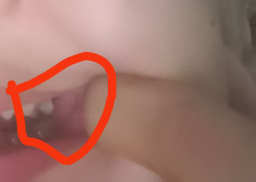 有没有东莞老哥知道把牙得多钱，智齿把旁边的老牙顶空了二分之一，疼了一晚上

12 / 作者:两条大河 / 