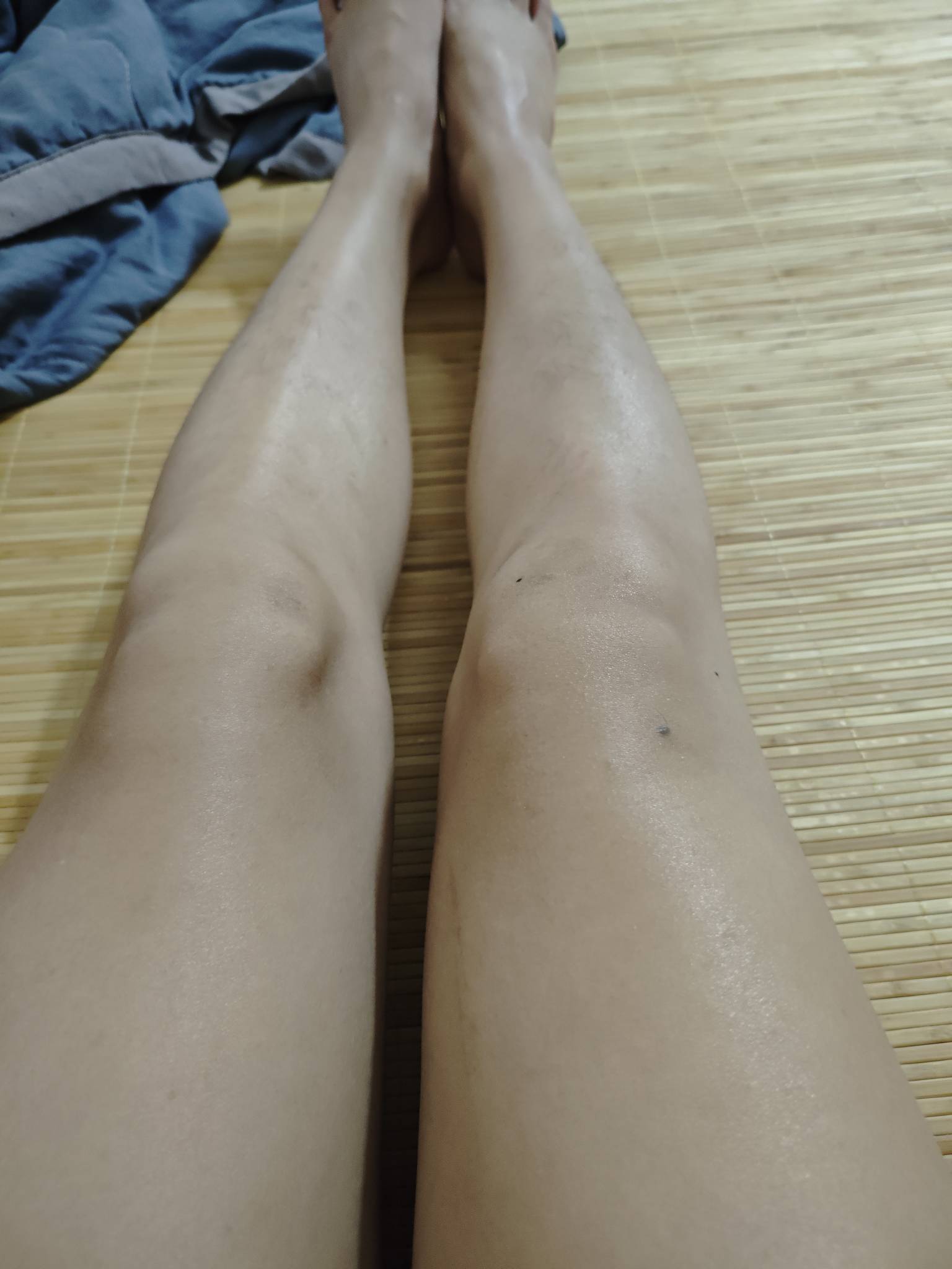 为啥我腿没毛呀？

68 / 作者:沉默_是金 / 