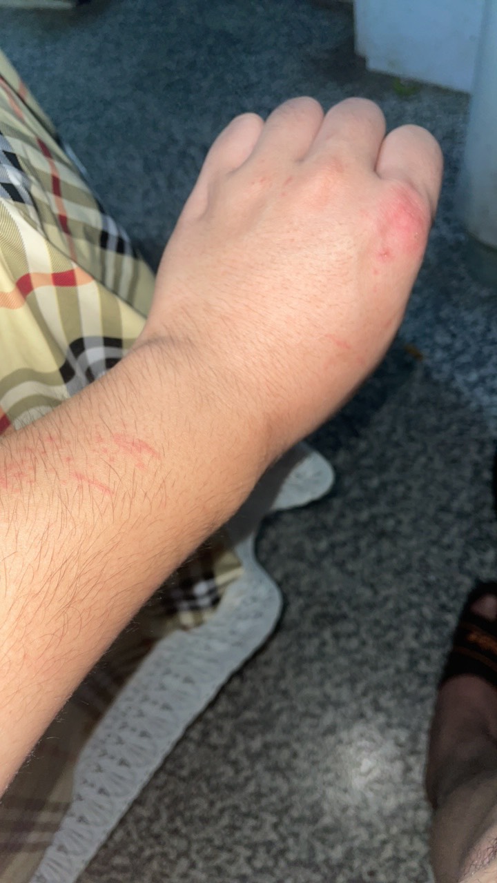 摘板栗搞的手都挂彩了！

35 / 作者:寻梦青年2 / 