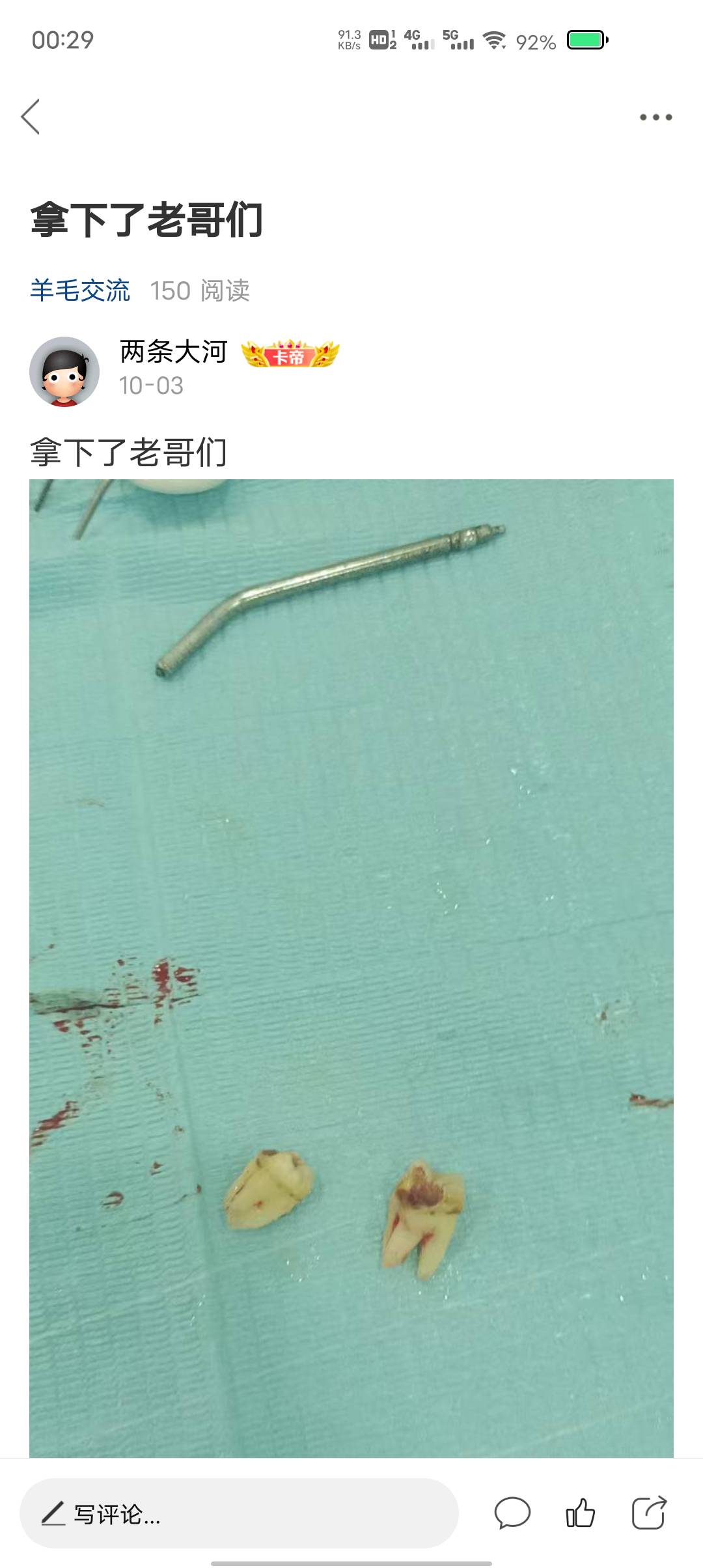 老哥们前几天拔牙，拔完之后今天发下牙根有一节断在里面了，没给我拔干净，二次过去还67 / 作者:两条大河 / 